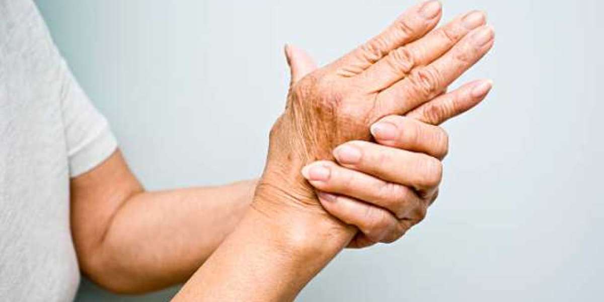 5 Effective Treatments for Rheumatoid Arthritis